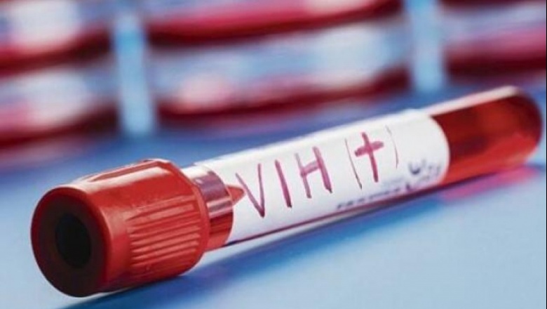 El 38% de los diagnósticos de VIH en jóvenes son tardíos